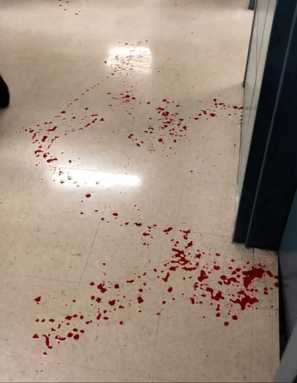 Teenager turns himself in after slashing student at Benjamin Cardozo High School in Bayside: NYPD